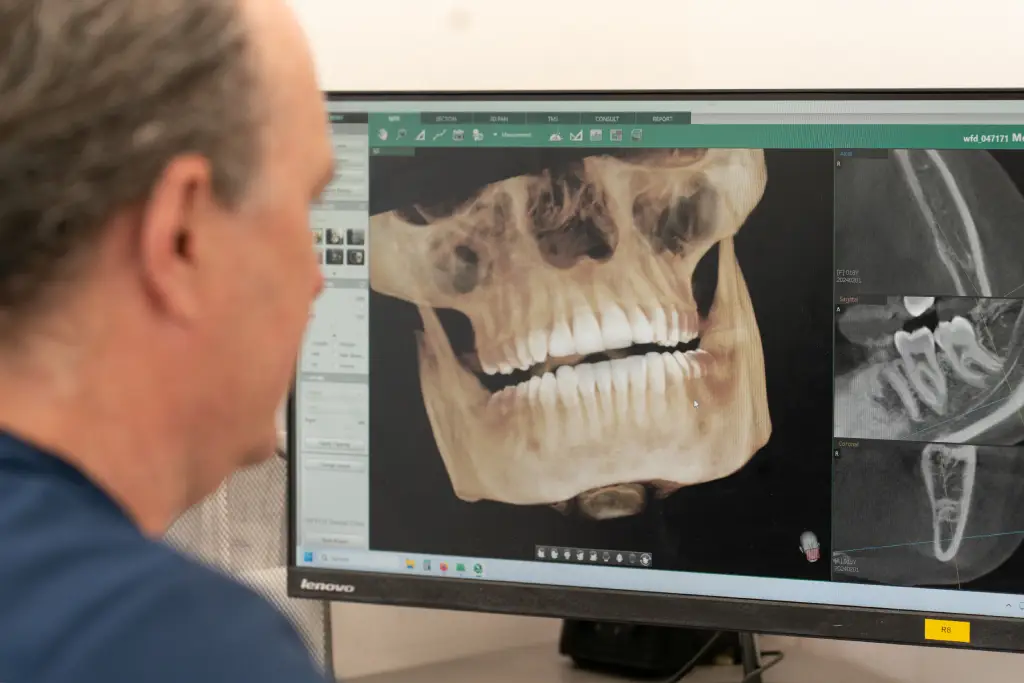 CBCT Scan